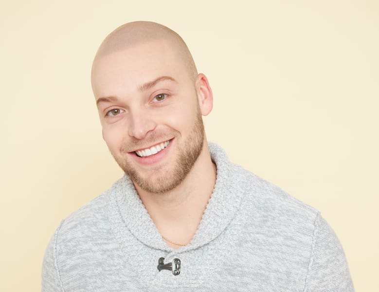 scalp micropigmentation blonde hair