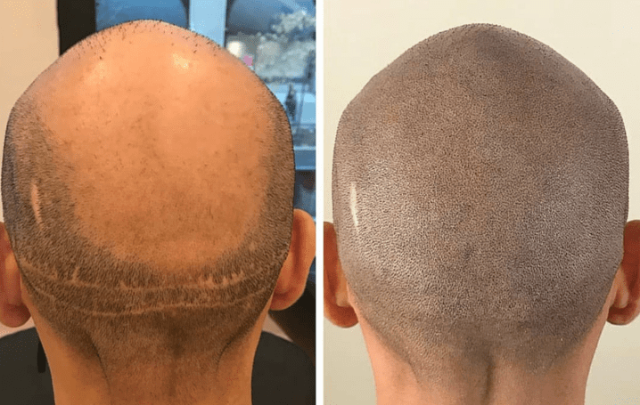 fue fut scar camouflage