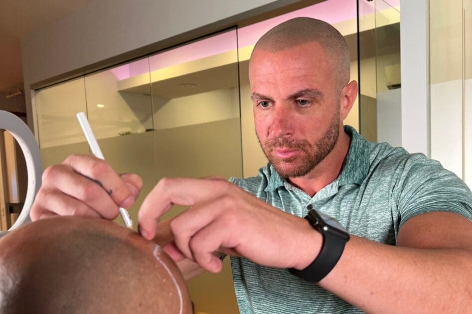 scalp-micro-usa-florida-scalp-micropigmentation