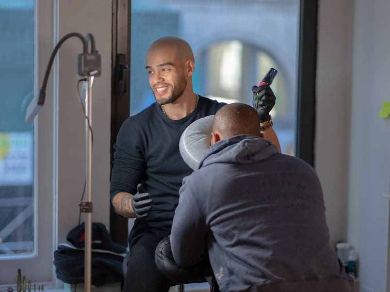 scalp micropigmentation hair loss help