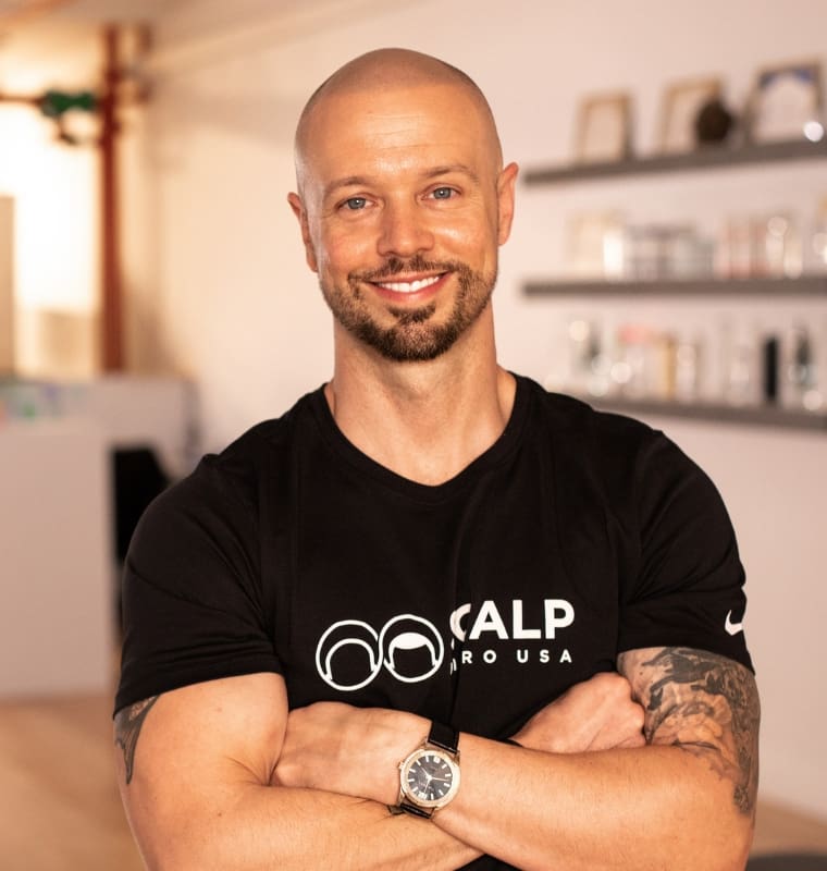 scalp micropigmentation los angeles ca