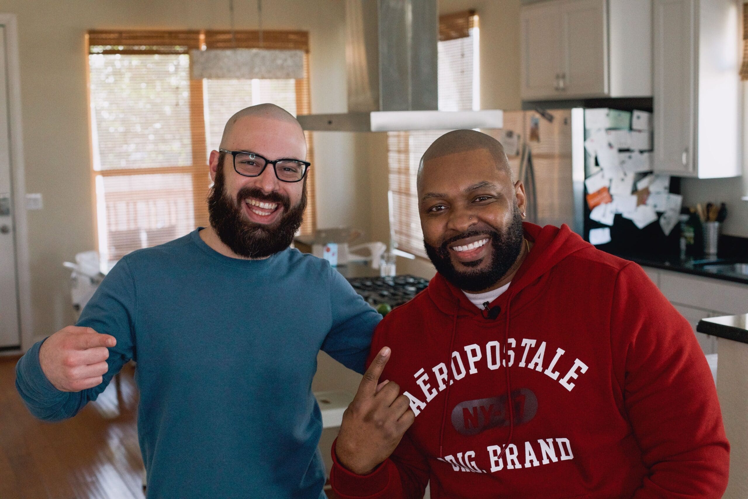 Scalp-micropigmentation-hair-loss-treatment-before-after-photo-micropigmentation-hair-tattoo-houston-texas-tx-graig-lauricella-min