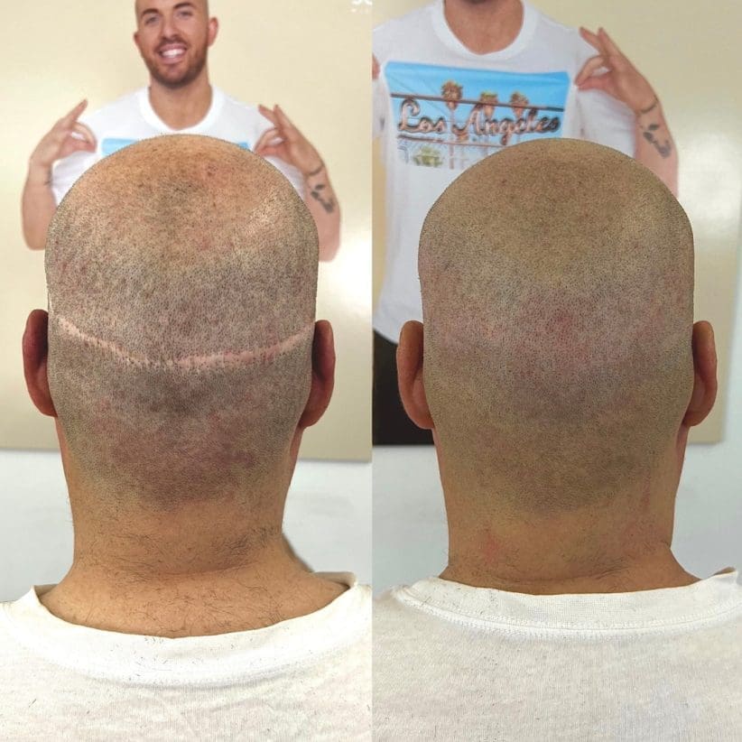 hair tattoo los angeles